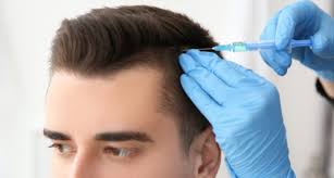 hair-transplant-bangalore