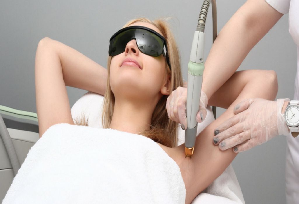 laser-hair-removal